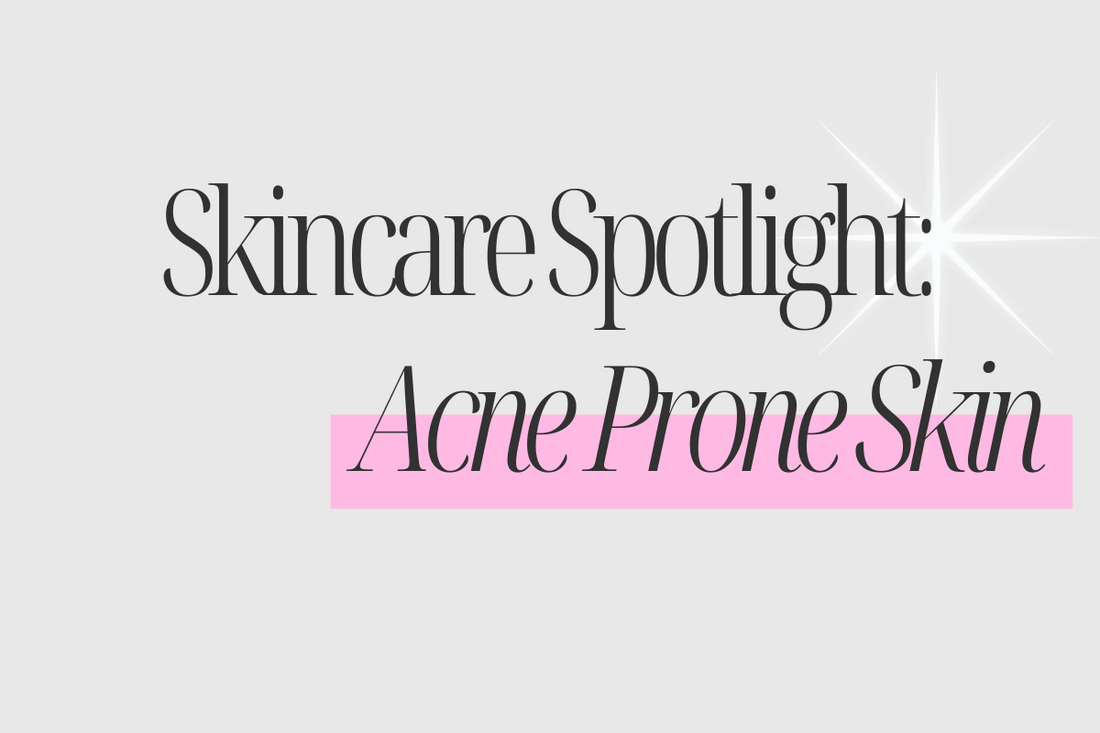 Skincare Spotlight: Top Products for Acne-Prone Skin